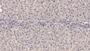 DAB staining on IHC-P; Samples: Human Liver Tissue;  Primary Ab: 10µg/ml Mouse Anti-Human RL Antibody Second Ab: 2µg/mL HRP-Linked Caprine Anti-Mouse IgG Polyclonal Antibody 