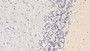 DAB staining on IHC-P; Samples: Human Cerebellum Tissue; Primary Ab: 20µg/ml Mouse Anti-Human RARS Antibody Second Ab: 2µg/mL HRP-Linked Caprine Anti-Mouse IgG Polyclonal Antibody