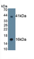 Amiloride Sensitive Sodium Channel Subunit Gamma (SCNN1g) Monoclonal Antibody, CAU30806