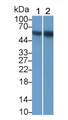 Receptor Interacting Serine Threonine Kinase 3 (RIPK3) Monoclonal Antibody, CAU30815