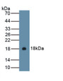 Interleukin 15 (IL15) Polyclonal Antibody, CAU30894