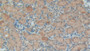 DAB staining on IHC-P; Samples: Mouse Kidney Tissue; Primary Ab: 20µg/ml Rabbit Anti-Mouse GFAP Antibody Second Ab: 2µg/mL HRP-Linked Caprine Anti-Rabbit IgG Polyclonal Antibody