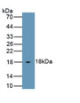 Leptin (LEP) Polyclonal Antibody, CAU30925