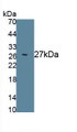 Prostate Specific Antigen (PSA) Polyclonal Antibody, CAU30971