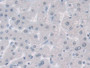 DAB staining on IHC-P;<br/>Samples: Human Liver Tissue; <br/>Primary Ab: 10µg/ml Rabbit Anti-Human Ub Antibody<br/>Second Ab: 2µg/mL HRP-Linked Caprine Anti-Rabbit IgG Polyclonal Antibody<br/>