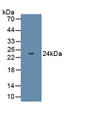 Interferon Beta (IFNb) Polyclonal Antibody, CAU30999