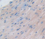Atrial Natriuretic Peptide (ANP) Polyclonal Antibody, Cat#CAU31001