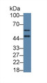 Vitamin D Receptor (VDR) Polyclonal Antibody, CAU31079