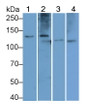 Procollagen I C-Terminal Propeptide (PICP) Polyclonal Antibody, CAU31145