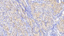 DAB staining on IHC-P; Samples: Human Kidney Tissue; Primary Ab: 20μg/ml Rabbit Anti-Human Slit2 Antibody Second Ab: 2µg/mL HRP-Linked Caprine Anti-Rabbit IgG Polyclonal Antibody