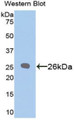 B-Cell Leukemia/Lymphoma 2 (Bcl2) Polyclonal Antibody, CAU31212