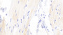 DAB staining on IHC-P; Samples: Rabbit Cardiac Muscle Tissue; Primary Ab: 10μg/ml Cavia Anti-Rabbit PPARg Antibody Second Ab: 2µg/mL HRP-Linked Rabbit Anti-Cavia IgG Polyclonal Antibody