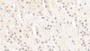 DAB staining on IHC-P; Samples: Rabbit Adrenal gland Tissue;  Primary Ab: 10μg/ml Cavia Anti-Rabbit PPARg Antibody Second Ab: 2µg/mL HRP-Linked Rabbit Anti-Cavia IgG Polyclonal Antibody 