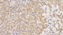 DAB staining on IHC-P; Sample: Human Liver Tissue; Primary Ab: 20ug/ml Rabbit Anti-Human ERK2 Antibody Second Ab: 2µg/mL HRP-Linked Caprine Anti-Rabbit IgG Polyclonal Antibody