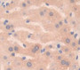 Used in DAB staining on fromalin fixed paraffin- embedded Kidney tissue