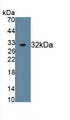 Fibroblast Growth Factor Receptor 2 (FGFR2) Polyclonal Antibody, CAU31462