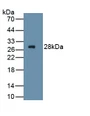 Frizzled Homolog 4 (FZD4) Polyclonal Antibody, CAU31464