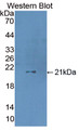 Coagulation Factor VII (F7) Polyclonal Antibody, CAU31486
