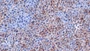 DAB staining on IHC-P; Samples: Mouse Liver Tissue;  Primary Ab: 10µg/ml Rabbit Anti-Mouse APOB Antibody Second Ab: 2µg/mL HRP-Linked Caprine Anti-Rabbit IgG Polyclonal Antibody 