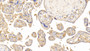 DAB staining on IHC-P; Samples: Human Placenta Tissue; Primary Ab: 20μg/ml Rabbit Anti-Human TRF Antibody Second Ab: 2µg/mL HRP-Linked Caprine Anti-Rabbit IgG Polyclonal Antibody