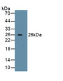 Ki-67 Protein (Ki-67) Polyclonal Antibody, CAU31531