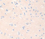 Adenomatosis Polyposis Coli Protein (APC) Polyclonal Antibody, Cat#CAU31551
