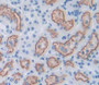 Used in DAB staining on fromalin fixed paraffin- embedded kidney tissue