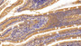Used in DAB staining on fromalin fixed paraffin- embedded Kidney tissue