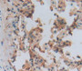 Used in DAB staining on fromalin fixed paraffin- embedded lung tissue