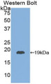 Thyroid Stimulating Hormone Beta (TSHb) Polyclonal Antibody, CAU31646