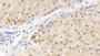 DAB staining on IHC-P; Samples: Human Liver Tissue; Primary Ab: 30µg/ml Rabbit Anti-Human MAPKAP1 Antibody Second Ab: 2µg/mL HRP-Linked Caprine Anti-Rabbit IgG Polyclonal Antibody