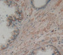 Used in DAB staining on fromalin fixed paraffin- embedded prostate gland tissue