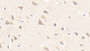 DAB staining on IHC-P; Samples: Human Cerebrum Tissue; Primary Ab: 20μg/ml Rabbit Anti-Human NR1D1 Antibody Second Ab: 2µg/mL HRP-Linked Caprine Anti-Rabbit IgG Polyclonal Antibody