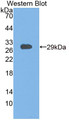 Testicular Receptor 4 (TR4) Polyclonal Antibody, CAU31708