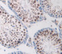 Used in DAB staining on fromalin fixed paraffin- embedded testis tissue