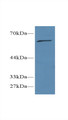 CREB Regulated Transcription Coactivator 1 (CRTC1) Polyclonal Antibody, CAU31720