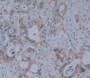 Used in DAB staining on fromalin fixed paraffin- embedded pancreas cancer tissue