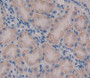 Used in DAB staining on fromalin fixed paraffin- embedded kidney tissue