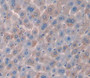 Used in DAB staining on fromalin fixed paraffin- embedded liver tissue