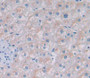 Used in DAB staining on fromalin fixed paraffin- embedded liver tissue