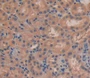 Used in DAB staining on fromalin fixed paraffin- embedded kidney tissue
