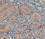 Used in DAB staining on fromalin fixed paraffin- embedded kidney tissue
