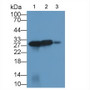 Calbindin (CALB) Polyclonal Antibody, CAU31844