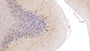 DAB staining on IHC-P; Samples: Human Cerebellum Tissue;  Primary Ab: 20µg/ml   Rabbit Anti-Human CALB Antibody Second Ab: 2µg/mL HRP-Linked Caprine Anti-Rabbit IgG Polyclonal Antibody 