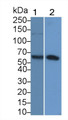Sal Like Protein 4 (SALL4) Polyclonal Antibody, CAU31885