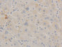 DAB staining on IHC-P; Samples: Human Liver Tissue;  Primary Ab: 10µg/ml Rabbit Anti-Human STAT3 Ant