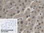 DAB staining on IHC-P; Sample: Human Liver Tissue Primary Ab: 30ug/ml Mouse Anti-Human GAPDH Antibody Control: Used PBS instead of primary antibody Second Ab: 2ug/ml HRP-Linked Caprine Anti-Mouse IgG Polyclonal Antibody
