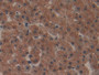 DAB staining on IHC-P; Samples: Human Liver Tissue; Primary Ab: 20ug/ml Rabbit Anti-Human COL1a1 Antibody; Second Ab: 2ug/mL HRP-Linked Caprine Anti-Rabbit IgG Polyclonal Antibody