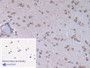 DAB staining on IHC-P; Sample: Human Cerebrum Tissue; Primary Ab: 30ug/ml Mouse Anti-Human BNP Antibody; Second Ab: 2ug/mL HRP-Linked Caprine Anti-Mouse IgG Polyclonal Antibody
