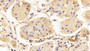 DAB staining on IHC-P; Sample: Human Stomach Tissue; Primary Ab: 10ug/ml Mouse Anti-Multi-species ACTb Antibody; Second Ab: 2ug/mL HRP-Linked Caprine Anti-Mouse IgG Polyclonal Antibody
